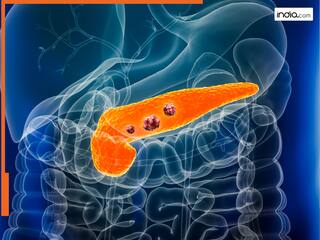 मोटापे से 20 प्रतिशत बढ़ सकता है पैंक्रियाटिक कैंसर का खतरा : Study