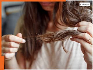 OMG! अपने ही सिर के बाल खा जाती थी ये लड़की, 16 साल से पेट में जमा हुआ बालों का गुच्छा; डॉक्टर के भी उड़े होश