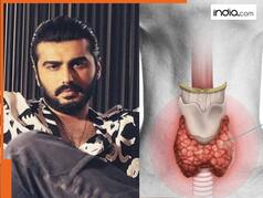 क्या है हाशिमोटो थायराइड? जिससे जूझ रहे हैं एक्टर Arjun Kapoor, जानें इसके शुरुआती लक्षण
