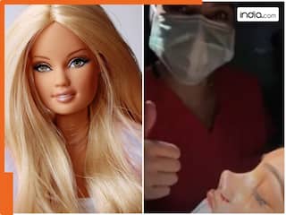 Barbie Doll जैसी नाक चाहती थी महिला, प्लास्टिक सर्जरी ने बिगाड़ दी शक्ल । देखें VIDEO