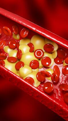 अर्जुन की छाल ही नहीं, इस फल का जूस भी कोलेस्ट्रॉल को जड़ से रौंद देता है