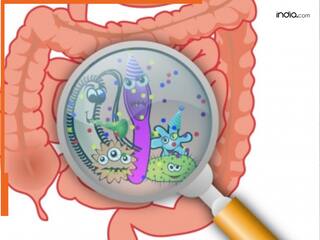 आंत के माइक्रोबायोम में परिवर्तन से हो सकता है रूमेटाइड गठिया : Study