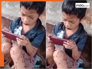 गेम खेलने की ऐसी लत... बच्चे की हालात देख हो जाएंगे आप भी हैरान