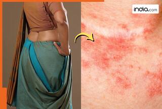 रुकिए! क्या आप भी बहुत कसकर बांधती हैं पेटीकोट? हो सकता है इस कैंसर का खतरा