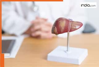 Fatty liver: These 6 home remedies can help prevent fat build up in liver