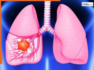 स्मोकिंग नहीं करने वाले लोगों को भी क्यों हो रहा लंग्स कैंसर? डॉक्टर ने बताई वजह