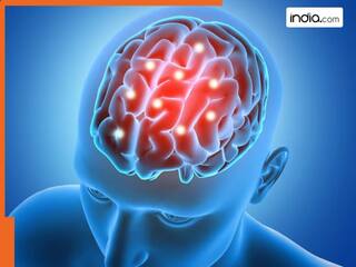 Brain stroke के क्या हैं शुरुआती लक्षण? किन लोगों को है ज्यादा खतरा- एक्सपर्ट ने बचने के बताए उपाय | VIDEO