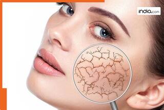 रूखी त्वचा को हाइड्रेट करने के लिए फॉलो करें ये 4 जरूरी Steps! दिनभर शाइन करेगी ड्राई स्किन