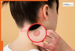 रोजमर्रा के इन 5 कामों से हो सकता है आपको स्किन इंफेक्शन का खतरा! गर्मियों में 10 गुना बढ़ जाता है रिस्क