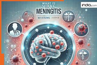 What is Viral Meningitis : Causes, symptoms, risk and prevention