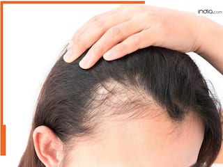 हेयर फॉल से हैं परेशान? 1 बार ट्राय करके देखें ग्रीन टी और दही का ये मास्क, आप भी कहेंगे खजाना हाथ लग गया