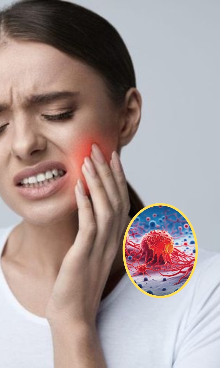 जबड़े में होने वाले कैंसर के ये 5 होते हैं शुरुआती लक्षण