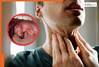 इग्नोर ना करें गले के आसपास होने वाले ये परिवर्तन! हो सकता हैं Throat Cancer होने का खतरा