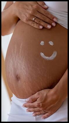 प्रेगनेंसी में होने वाले Stretch Marks को हटाने के लिए अपनाएं ये घरेलू टिप्स