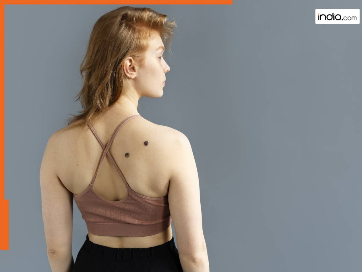 शरीर पर मौजूद तिल बताएगा कैसा होगा आपका जीवनसाथी? शादी के बाद बदल जाती है इन लोगों की जिंदगी