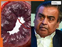 कोरोना के बाद दबे पांव फैल रही एक और खतरनाक बीमारी! अंबानी परिवार में इस शख्स को बनाया था शिकार