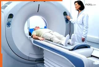 क्या वाकई CT स्कैन कराने से कैंसर होता है? डॉक्टर से जानें सच