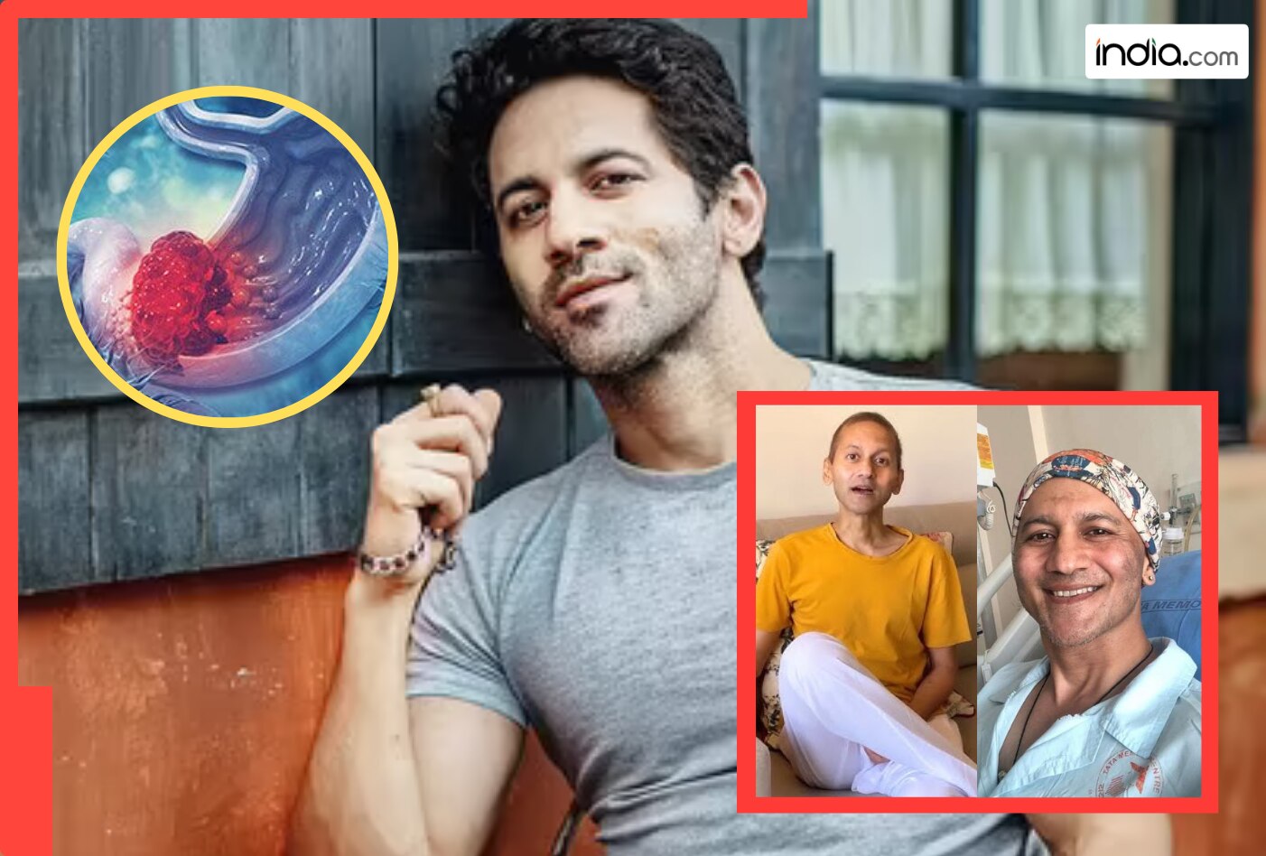 Colon Cancer ने ली इस मशहूर एक्टर की जान! युवाओं में बढ़ रहा इस कैंसर का खतरा...जानें शुरूआती लक्षण