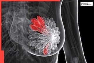 ब्रेस्ट कैंसर के रिस्क को कई गुना कम करते हैं ये 5 फूड आइटम्स....बनाएं अपनी डाइट का हिस्सा