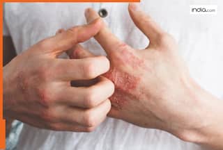 त्वचा पर नजर आने लगते हैं डायबिटीज के ये लक्षण, समय रहते पहचानें और करें बचाव