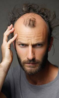 अपच बन सकता है आपके बाल झड़ने का कारण...जानिए कैसे?