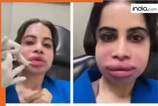 Uorfi Javed's swollen face post lip filler dissolving goes viral, Here are 5 risks you should know before the procedure