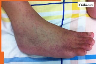 China under grip of this disease, hospitals are crowded, it is...