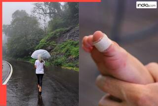 बारिश में क्यों बढ़ जाता है घाव में इंफेक्शन का खतरा? 99% लोगों को नहीं पता होगा सही जवाब