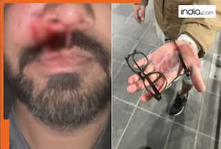 'They left me bleeding...': Indian-origin man suffers fractured cheekbone after brutal attack in alleged hate crime in Ireland