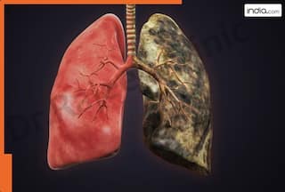 World Lung Cancer Day 2025: इन 5 कारणों से शरीर में बढ़ता है फेफड़ों में कैंसर होने का खतरा...आज ही इन आदतों से कर लें तौबा