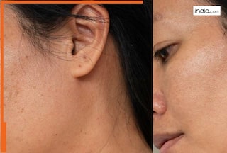 काले धब्बों से छुटकारा दिलाएगा इस सब्जी का जूस, जानें इसके कमाल के फायदे