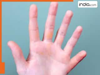 क्या सच में छह अंगुली वाले लोग होते हैं भाग्यशाली और बुद्धिमान? पढ़िए दिलचस्प तथ्य