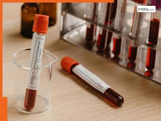 Viral News: तनाव कम करने के लिए शख्स ने घर में घुस महिला का निकाला खून, कोर्ट ने भेजा जेल