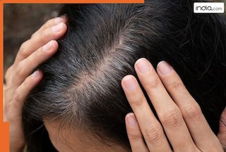 किस विटामिन की कमी से होने लगते हैं सफेद बाल? 99% लोगों को नहीं पता होगा सही जवाब