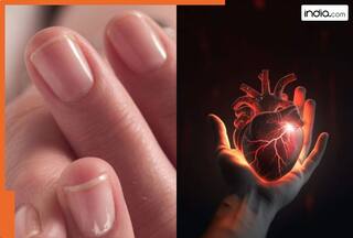 आपके नाखूनों से पता चल सकता है हार्ट अटैक का खतरा....भूलकर भी नजरअंदाज ना करें ये लक्षण
