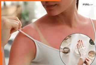 हाथ-पैरों की टैनिंग अब मिनटों में होगी छूमंतर, बस किचन से उठाकर ये चीज रगड़ना कर दें शुरू