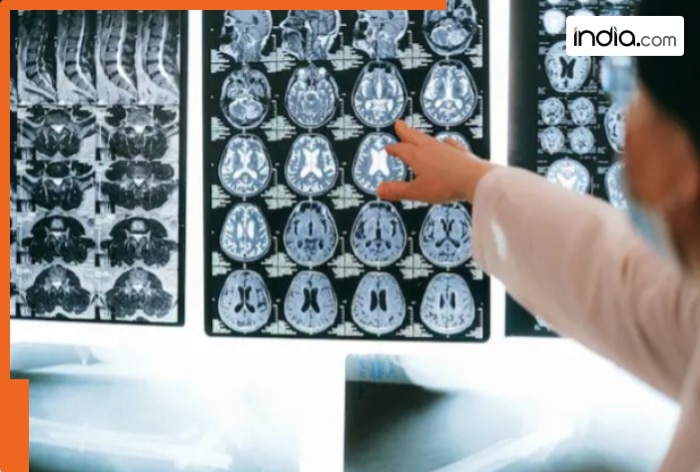 Brain-eating Amoeba in Kerala: What is Primary Amoebic Meningoencephalitis? Know symptoms, risks and how to stay safe