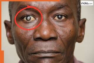 अंधा कर सकती हैं आंखों से जुड़ी ये 5 बीमारियां! परेशानी को बिल्कुल ना समझें साधारण