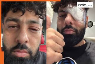 Rapper Badshah shares photos with swollen eye and bandage, fans ask 'Kya hua bhai'