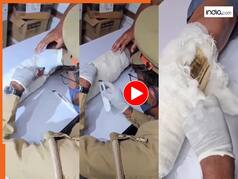 Chor Ka Video: सोना रखकर पैर में चढ़वा लिया प्लास्टर, पुलिस ने चेक किया तो होश ही उड़ गए | देखें वीडियो