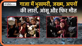 GAZA के 21000 बच्चे विकलांग.. भूख से 130 की मौत,  सवा लाख से ज्यादा की कुपोषण से मौत का अनुमान