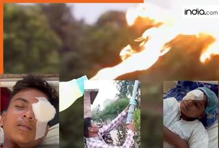 What are Carbide Guns that have robbed dozens of children of their eyesight in several states?