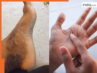 दिवाली की सफाई करते करते खराब हो चुके हैं हाथ-पैर? अपनाएं ये 5 घरेलू नुस्खे! मखमल जैसे दोबारा सॉफ्ट हो जाएगी स्किन