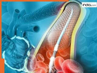 किन 5 लक्षणों के बाद एंजियोप्लास्टी कराना होता है जरूरी? पहचानकर तुरंत डॉक्टर से लें परामर्श