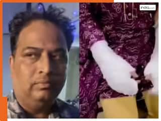 Delhi Acid Attack: पिता ने ही रची साजिश; बेटी ने खुद अपने ऊपर डाला 'एसिड', CCTV फुटेज से मुख्य आरोपी को मिली क्लीनचिट