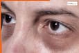 Dark Circles को कहें Bye Bye! सिर्फ 2 मिनट में इन फेस एक्सरसाइज से पाएं नेचुरल ग्लो Dark Circles को कहें Bye Bye! सिर्फ 2 मिनट में इन फेस एक्सरसाइज से पाएं नेचुरल ग्लो