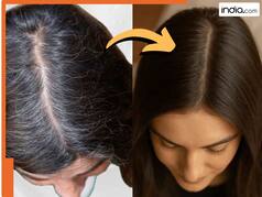 सफेद बालों से हो चुके हैं परेशान? घने और काले बालों के लिए अपनाएं ये घरेलू नुस्खे