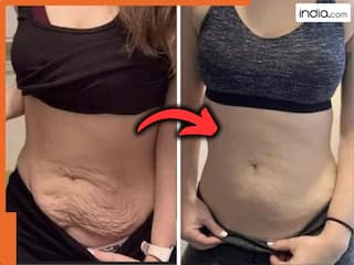 प्रेग्नेंसी के बाद थुलथुले पेट को अंदर करने के लिए अपनाएं ये असरदार नुस्खे! महीनेभर में अंदर चला जाएगा सारा पेट