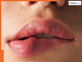 फटे होठों से छुटकारा पाने के लिए अपनाएं ये 5 घरेलू उपाय! बेबी सॉफ्ट हो जाएगी स्किन