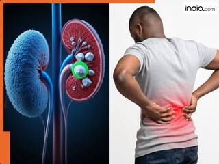 किडनी के अलावा इन 4 जगहों पर भी होता है पथरी होने का खतरा! जानिए इससे बचाव के असरदार उपाय